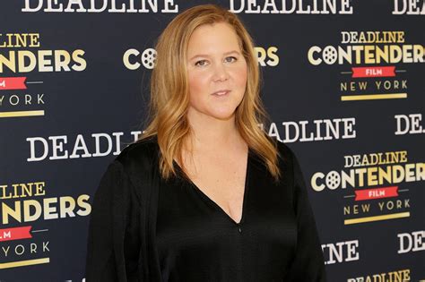 Amy Schumer Reveals She Has Hair Pulling Disorder