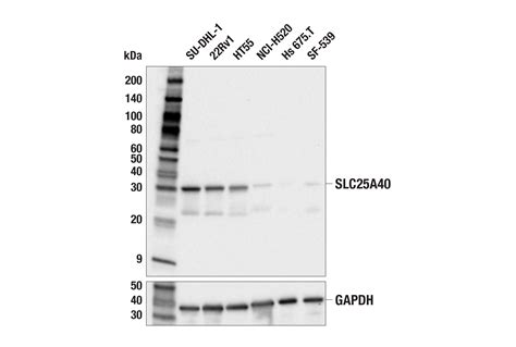 Slc A E C Y Rabbit Mab Cell Signaling Technology