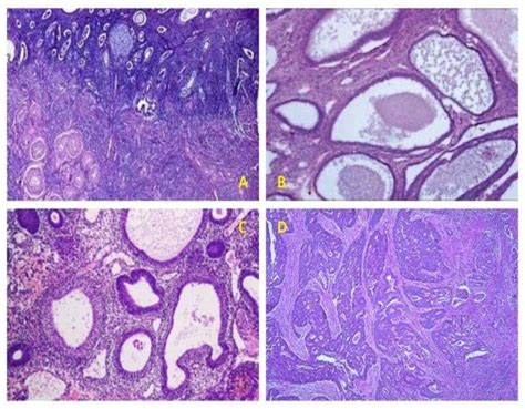 Patterns Seen In Majority Of Premenopausal Endometrium A