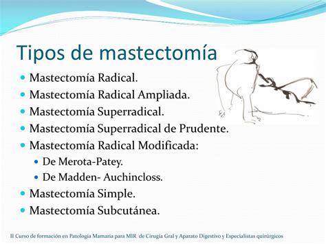 PPT Mastectomías PowerPoint Presentation free download ID 1930434