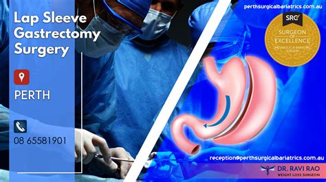 Lap Sleeve Gastrectomy Surgery Perth Imgpile