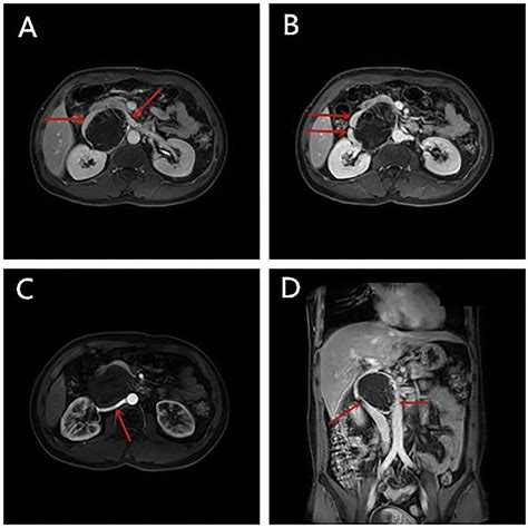 Frontiers Clinical Characteristics And Treatment Strategy Of