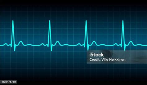 Detak Jantung Ekg Biru Monitor Denyut Nadi Dengan Sinyal Ikon Ilustrasi