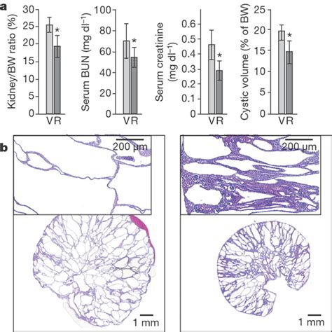 Roscovitine Effectively Attenuates Disease Progression In Cpk Mice A Download Scientific