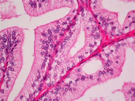 Kit de tinción rápida con hematoxilina eosina de secciones congeladas y