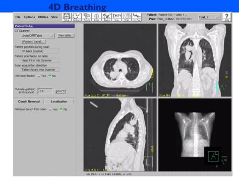 Ppt 4d Adaptive Radiotherapy And Tomotherapy Powerpoint Presentation Id5085464