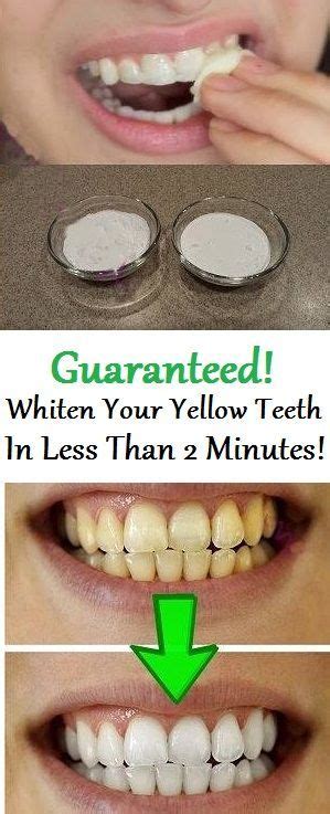 Guaranteed Whiten Your Yellow Teeth In Less Than 2 Minutes Beautiful Diy And Health