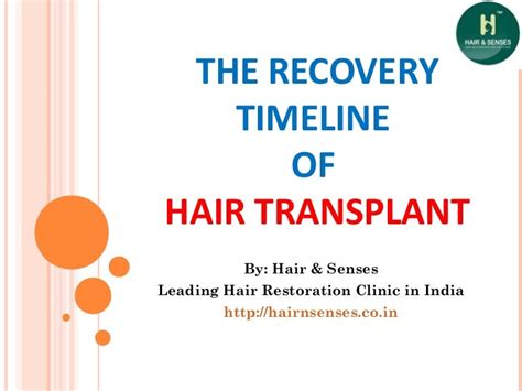 The Recovery Timeline of Hair Transplant