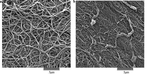 Scanning Electron Micrographs Of Plasma Fibrin Clots From The Proband Download Scientific