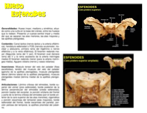 SOLUTION Hueso Esfenoides Anatomia Humana Studypool