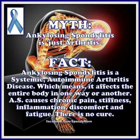 Ankylosing Spondylitis Diagnosis Diet Carbohydrate