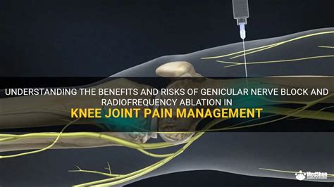 Understanding The Benefits And Risks Of Genicular Nerve Block And