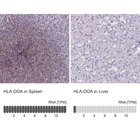 Hla Doa Polyclonal Antibody Pa5 60904