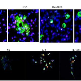 Double Immunofluorescent Staining Of Hdac And Cal Expression