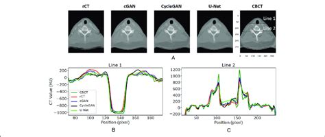 An Example Of The Hu Line Profiles Of Rct Sct And Cone Beam Computed Download Scientific