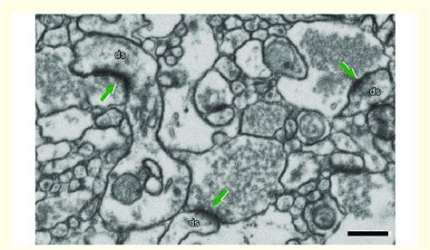 Identification Of Synapses In Em Image Obtained By Fib Sem On The