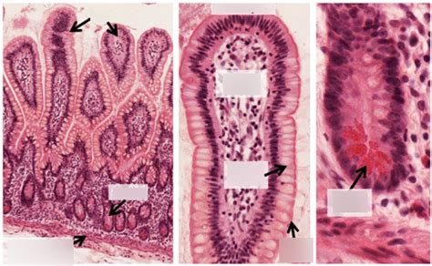 Ileum Histology Slide Diagram Quizlet