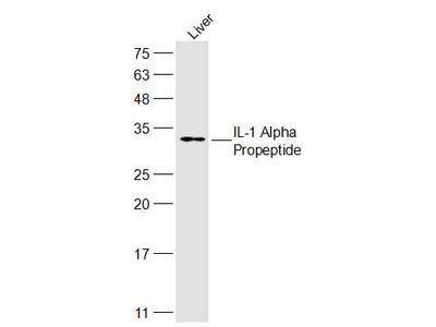 Anti IL1A Antibody Products Biocompare