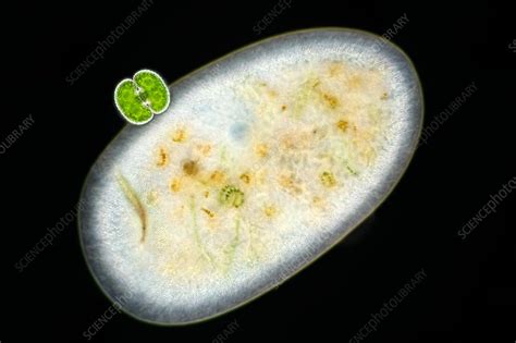 Frontonia Sp Protist With Algae Light Micrograph Stock Image C0405121 Science Photo Library