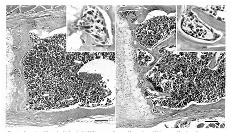 Figure 2 From Spontaneous Fibro Osseous Proliferative Lesions In The Sternums And Femurs Of