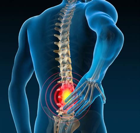 Spinal Injections For Back Pain