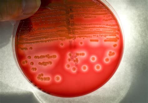 The 'Psychobiome': Bacteria That Alter Your Behavior | RealClearScience