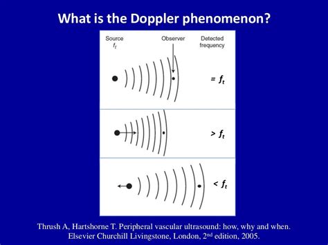 Principles Of Doppler Ultrasound