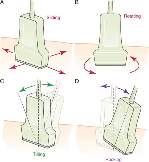 POINT-OF-CARE ULTRASOUND - Clinical Tree