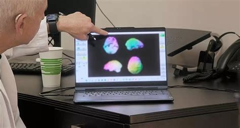 Kim Kardashian reveals she has ‘low brain activity’ after brain scan ...