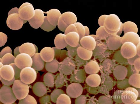 Staphylococcus Epidermidis Photograph By Scimat Pixels