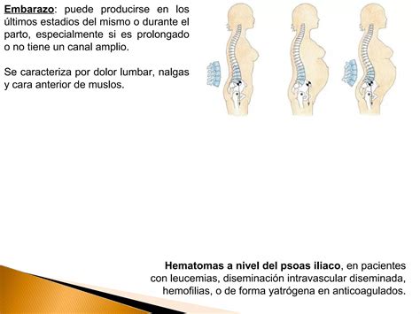 Lesi N De Plexo Lumbosacro Ppt