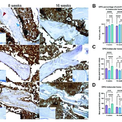 immunohistochemical reaction  osteoprotegerin opg