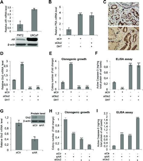 Glo Involvement In Prostate Tumorigenesis Is Dependent On Ar