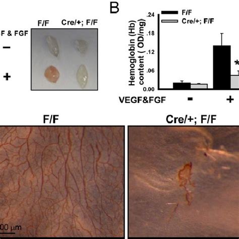 Essential Role Of Coup Tfii In Adult Angiogenesis A Control F F