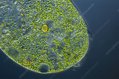 Stentor Protozoan Light Micrograph Stock Image C Science