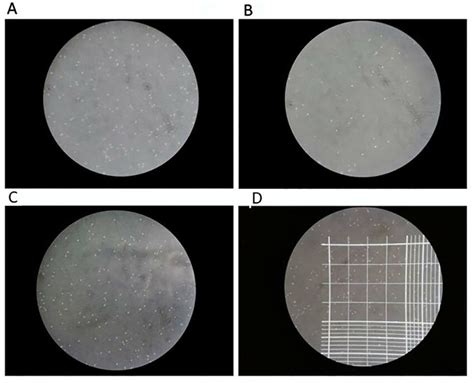 Representative images of trypan blue staining of peripheral blood ...