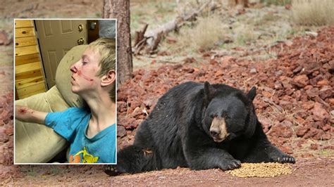 Arizona Teenage Survives Black Bear Attack In Alpine A Blessing Fox News