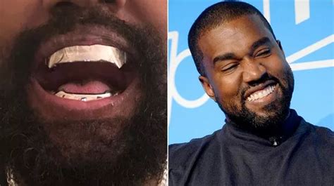 What are titanium teeth? Kanye West’s $850,000 'experimental' dental makeover explained - The ...