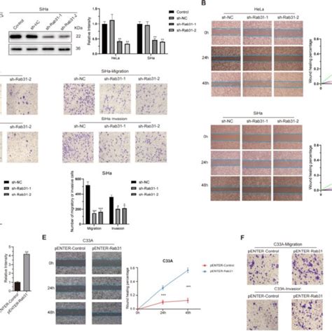 Rab31 Promotes The Migration And Invasion Of Cervical Cancer Cells A Download Scientific