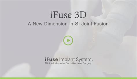 Ifuse 3d™ Si Bone