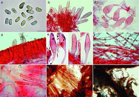 Microscopic characters in Mycena dura. a. basidiospores in Melzer´s... | Download Scientific Diagram