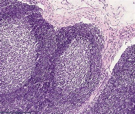 Histology Guide Lymph Node