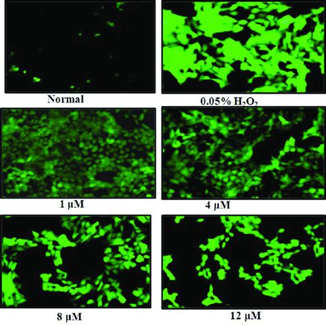 Detection Of ROS Generation In HCT 116 Cells The Cells Were Treated