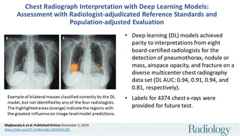 Chest Radiograph Interpretation With Deep Learning Models Assessment