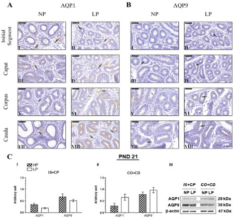 Expression And Immunolocalization Of Aquaporins Aqp And Aqp In The