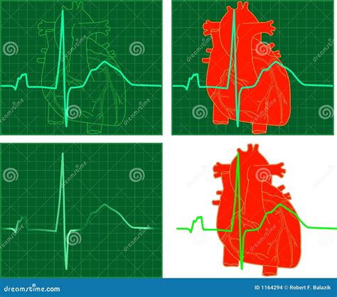 Ekgecg Stock Vector Illustration Of Raster Clip Rhythms 1164294