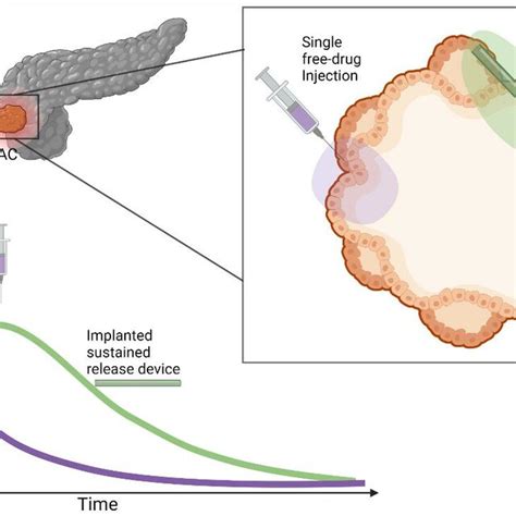 Motivation For Sustained Delivery Implants For Treatment Of PDAC