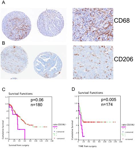 High And Low Density Of Cd68 Tumor Associated Macrophages Tam A Download Scientific