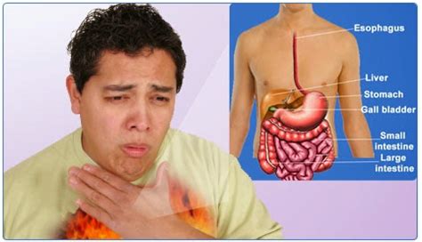 indigestion symptoms - the Truth About It | Symptoms of Disease