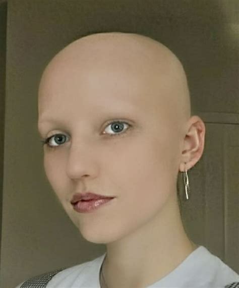 Pin By Ashley Boasso On Bald And Browless Women In 2024 Bald Women